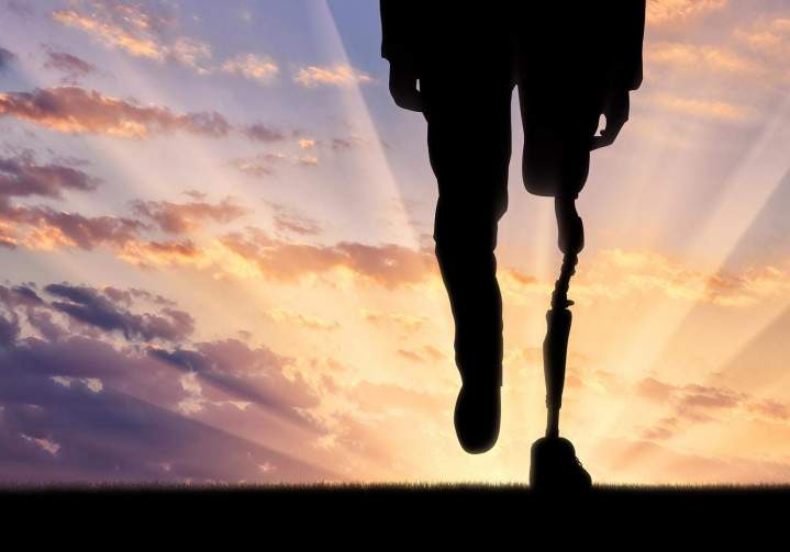 Orthopédiste Antilles et Guyane