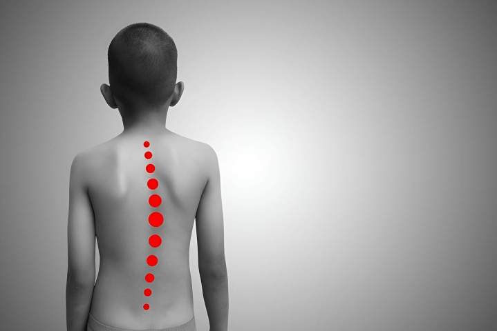 Orthopédiste Antilles et Guyane