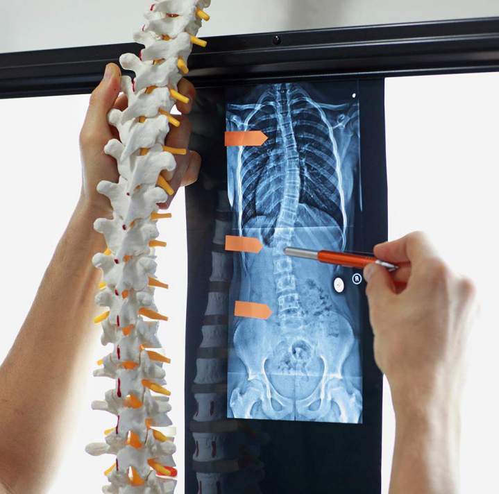 Orthésiste Antilles et Guyane