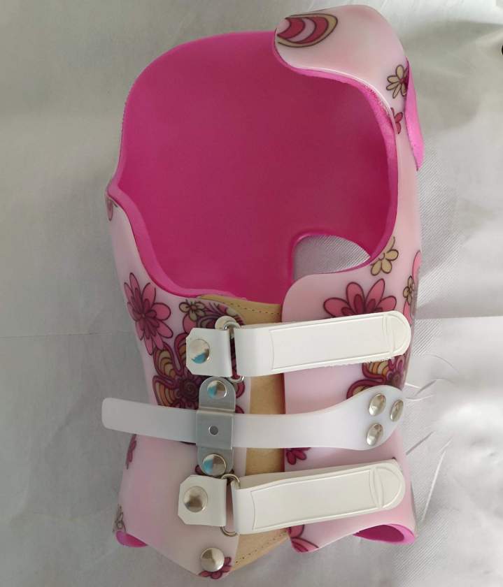 Fabrication de corsets médicaux pour les déformations du dos