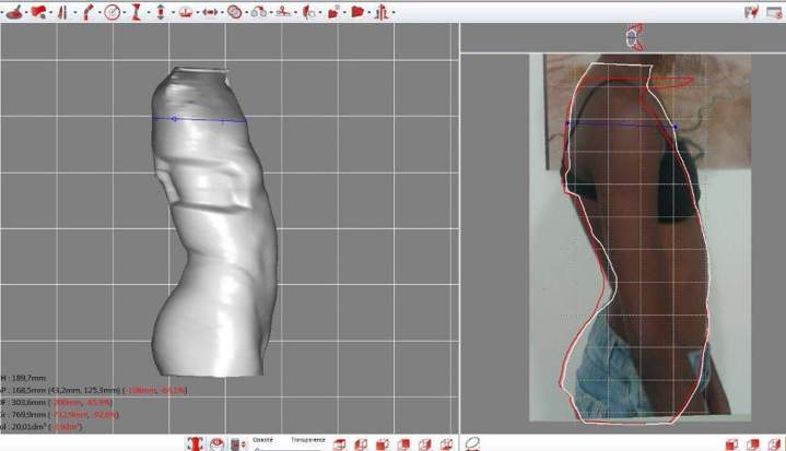 Prescription d'orthèse Antilles et Guyane