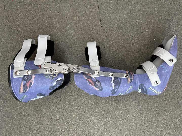 Des orthèses adaptées pour compenser, corriger et soulager vos douleurs