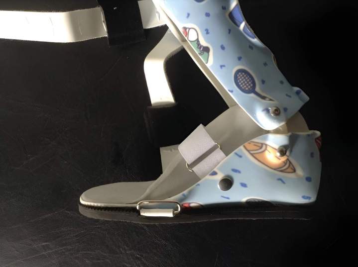 Orthèse sur mesure Antilles et Guyane